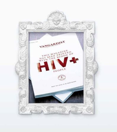 HIV