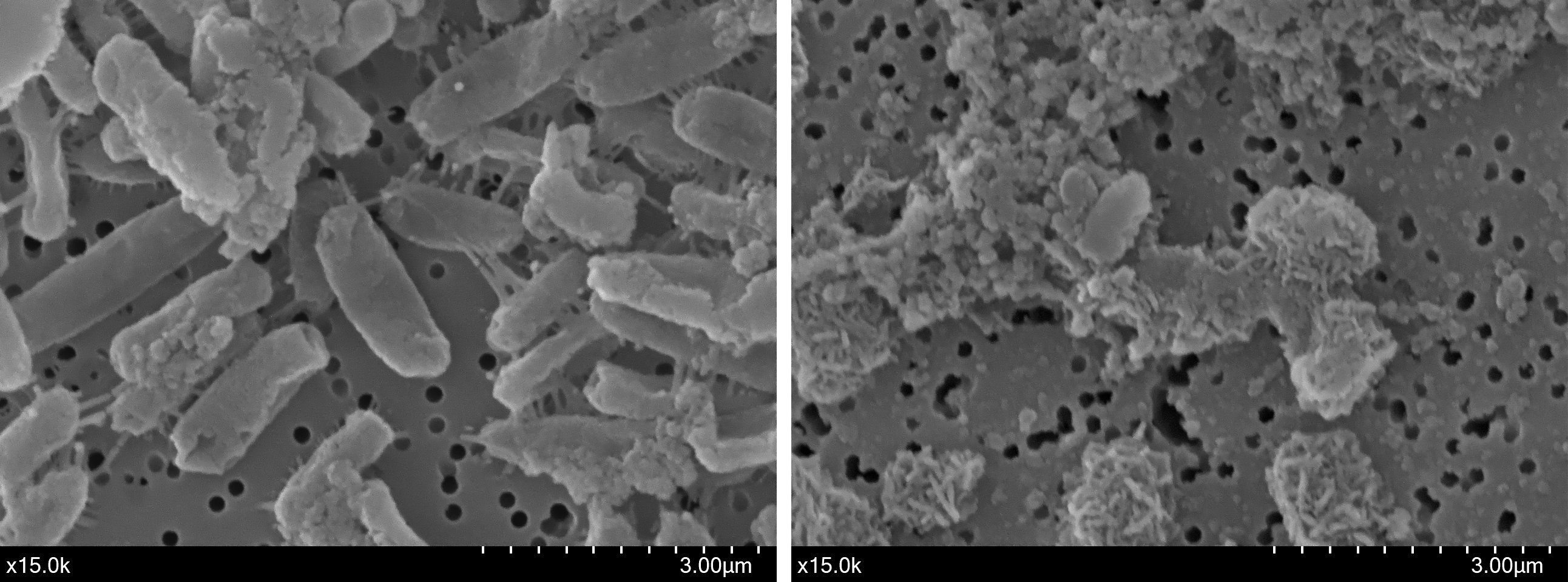 E coli Serum
