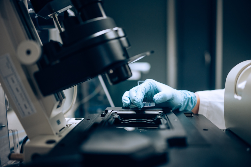 Neue Hoffnung bei AML: 3D-Modell stärkt NK-Zell-Therapien