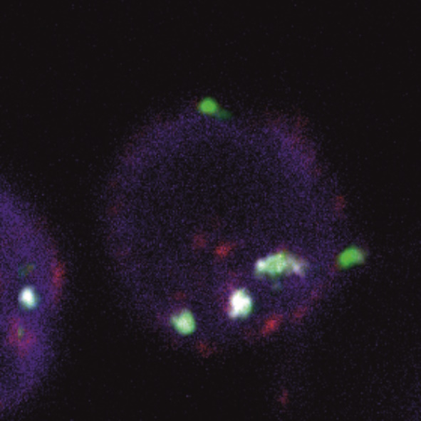 EV immunfluoreszierend